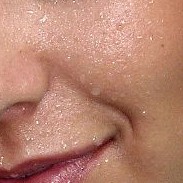 sweating face